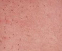 Определяем и выводим щетину у новорождённых народными средствами